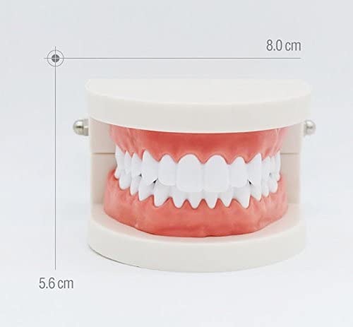 Airgoesin Dental Standard Teeth Study Teaching Model Kids Patient Education Caries Treatment Decayed Tooth Model