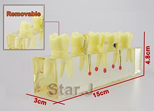 Dental Dentist Endo Endodontic Demonstration Root Treatment Model