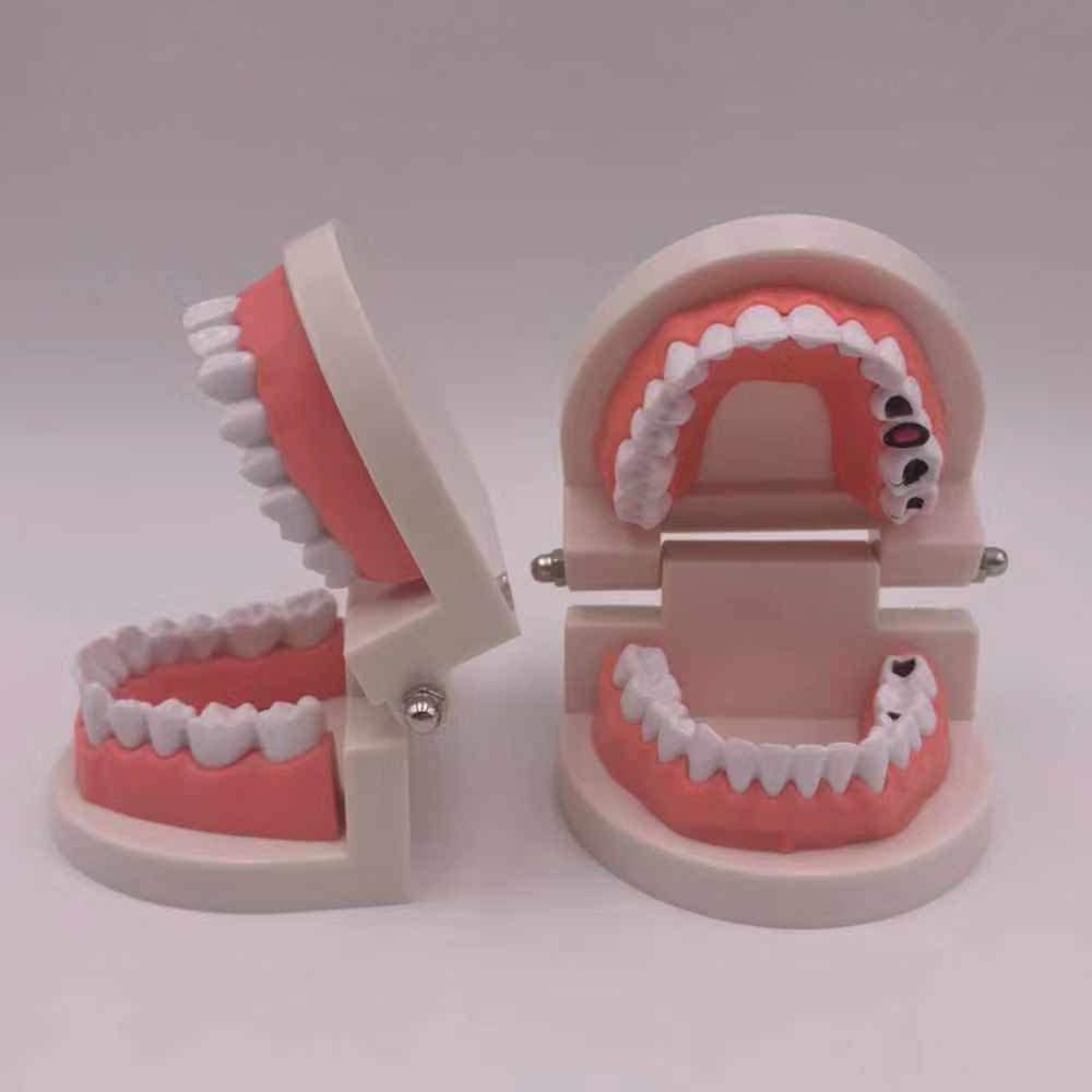 Airgoesin 2pcs Tooth Brushing Model Standard Typodont Demonstration Teeth Disease Decayed Teeth Model for Kids and Students Study Teaching Dental Clinic Oral Care