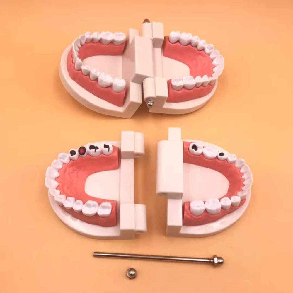 Airgoesin 2pcs Tooth Brushing Model Standard Typodont Demonstration Teeth Disease Decayed Teeth Model for Kids and Students Study Teaching Dental Clinic Oral Care