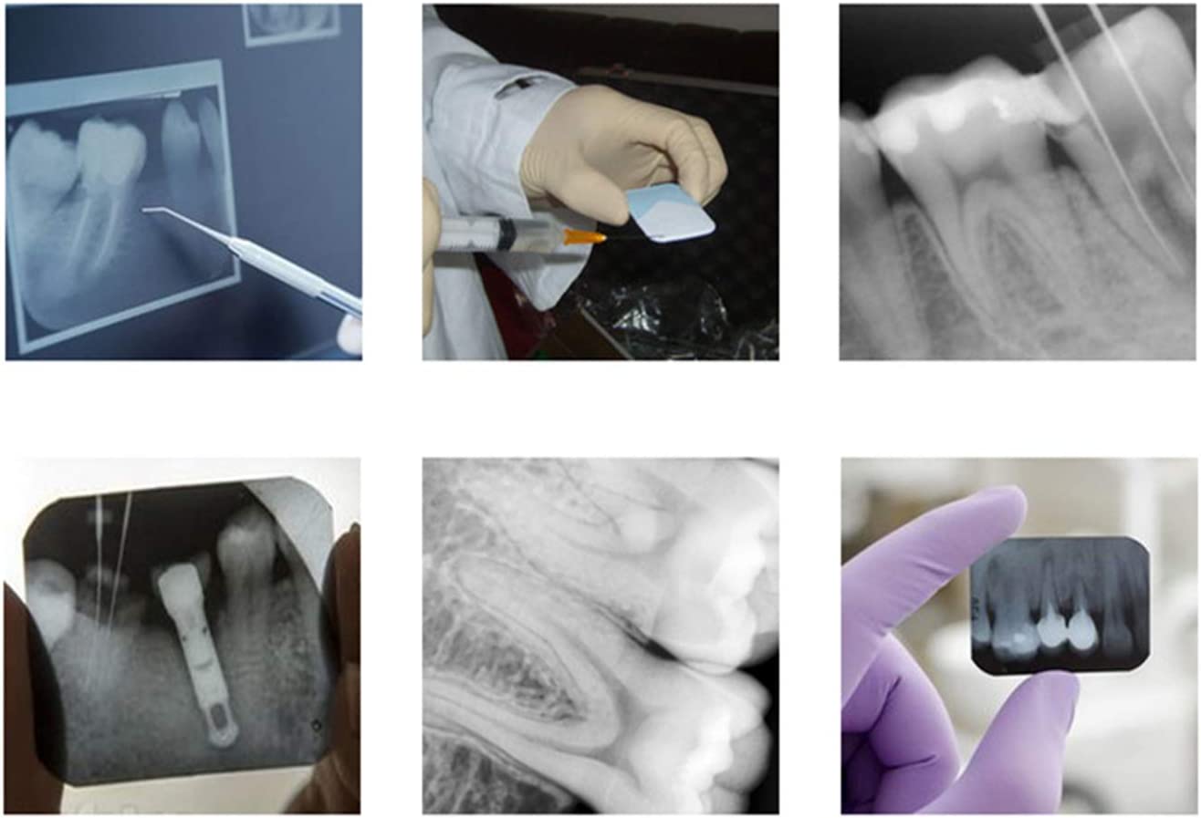 Dental Xray Film Imaging Processor Darkroom Portable Developer for Periapical X Ray Ideal