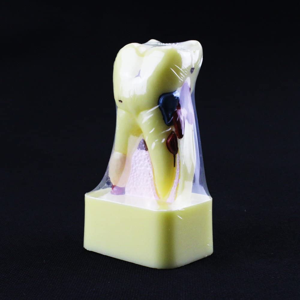 New Dental Dentist Study School Teaching Model Teeth Comprehensive Disease Model