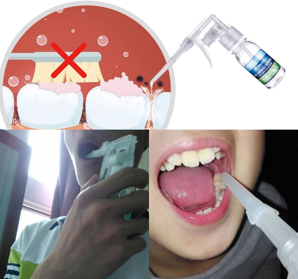 Airgoesin Oral Washer Flosser Dental Water Irrigator Teeth Fresh Breath Rinse Tonsil Stone Cleaner Jet Pick Portable for Office or Travel use