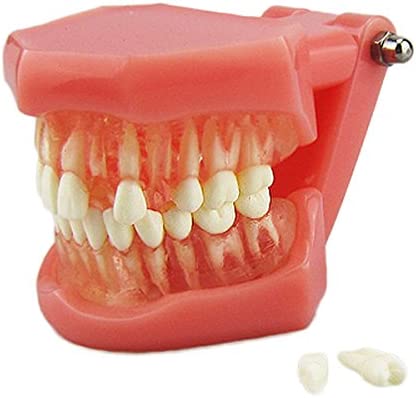 New - Dental Standard Teeth Tooth Model with Removable Teeth & Transparent Gum