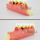 Dental Periodontal Disease assort Tooth Teeth Typodont Study Teaching Model New