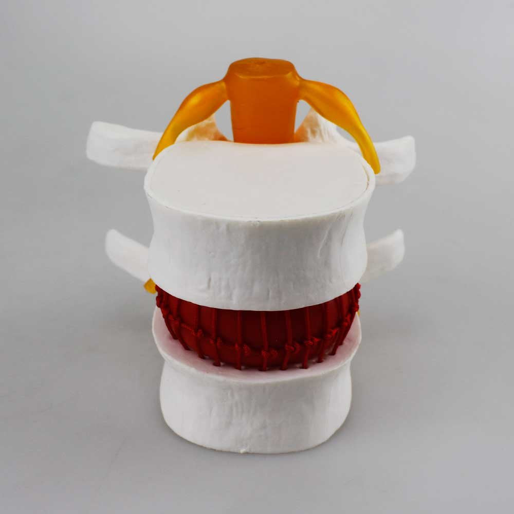 Airgoesin Human Cervical Spinal Cord Vertebral Intervertebral Disc Spine Display Model