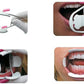 Airgoesin Oral Intraoral Cheek Lip Retractor Opener Mouth Prop Tooth Whitening 3D Adult Dental Tool