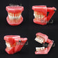 New - Dental Standard Teeth Tooth Model with Removable Teeth & Transparent Gum