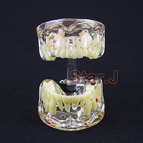 ChildrenTooth Model Dental Transparent Demonstration Child Kid's Teeth Model Typodont