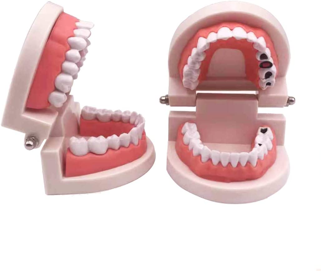 Airgoesin 2pcs Tooth Brushing Model Standard Typodont Demonstration Teeth Disease Decayed Teeth Model for Kids and Students Study Teaching Dental Clinic Oral Care