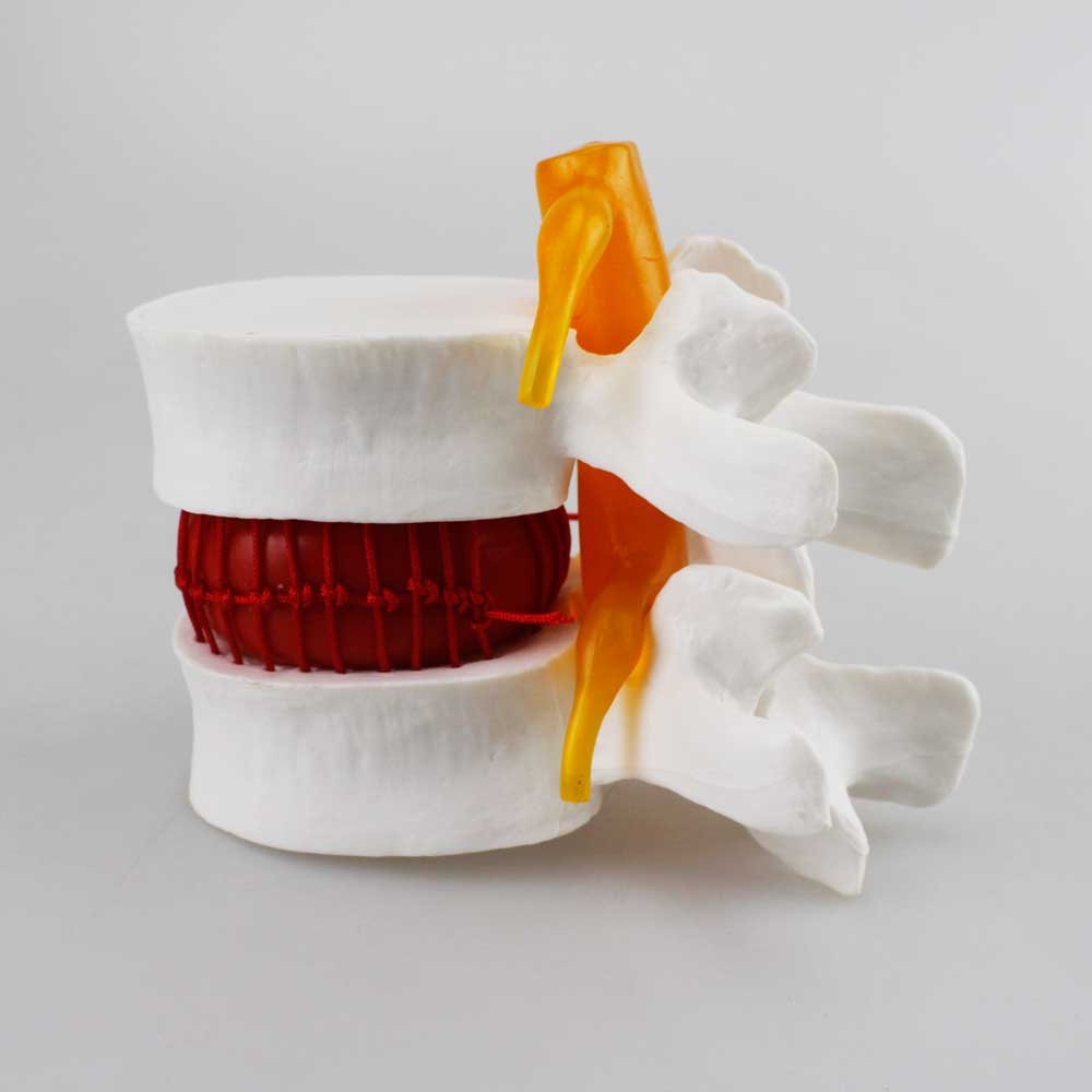 Airgoesin Human Cervical Spinal Cord Vertebral Intervertebral Disc Spine Display Model