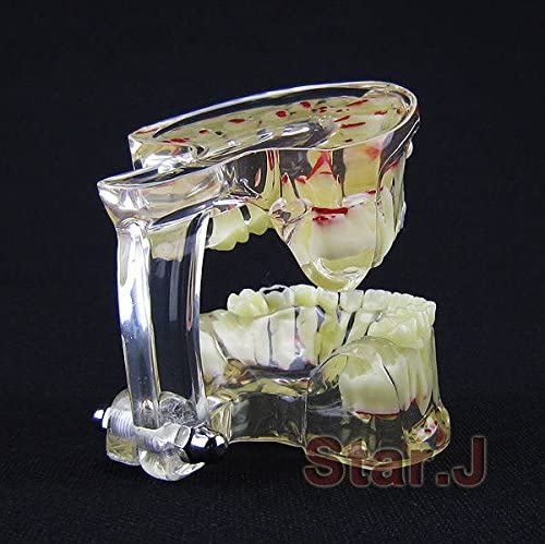 ChildrenTooth Model Dental Transparent Demonstration Child Kid's Teeth Model Typodont