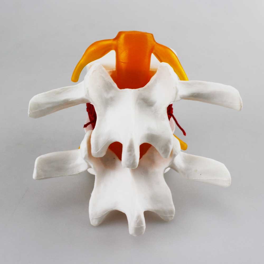 Airgoesin Human Cervical Spinal Cord Vertebral Intervertebral Disc Spine Display Model