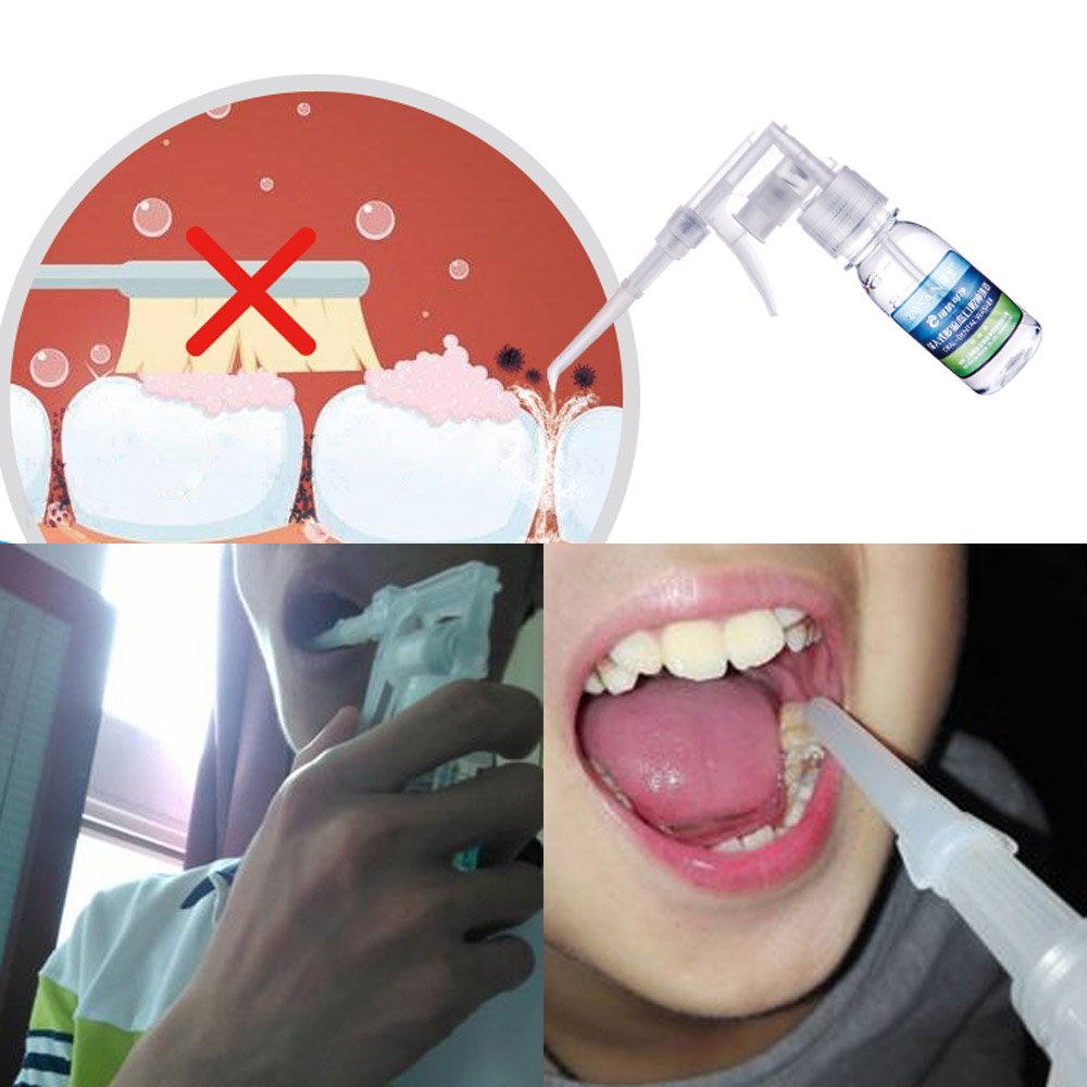 Airgoesin Oral Washer Flosser Dental Water Irrigator Teeth Fresh Breath Rinse Tonsil Stone Cleaner Jet Pick Portable