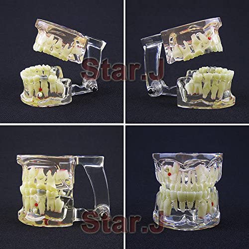 ChildrenTooth Model Dental Transparent Demonstration Child Kid's Teeth Model Typodont