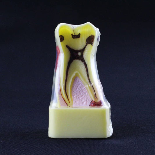 New Dental Dentist Study School Teaching Model Teeth Comprehensive Disease Model