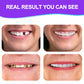 Artificial Teeth, Cosmetic Denture Veneers for Upper and Lower Jaw, Natural Shade Fake Veneer for Temporary Fix Confident Smile - 2 PCS